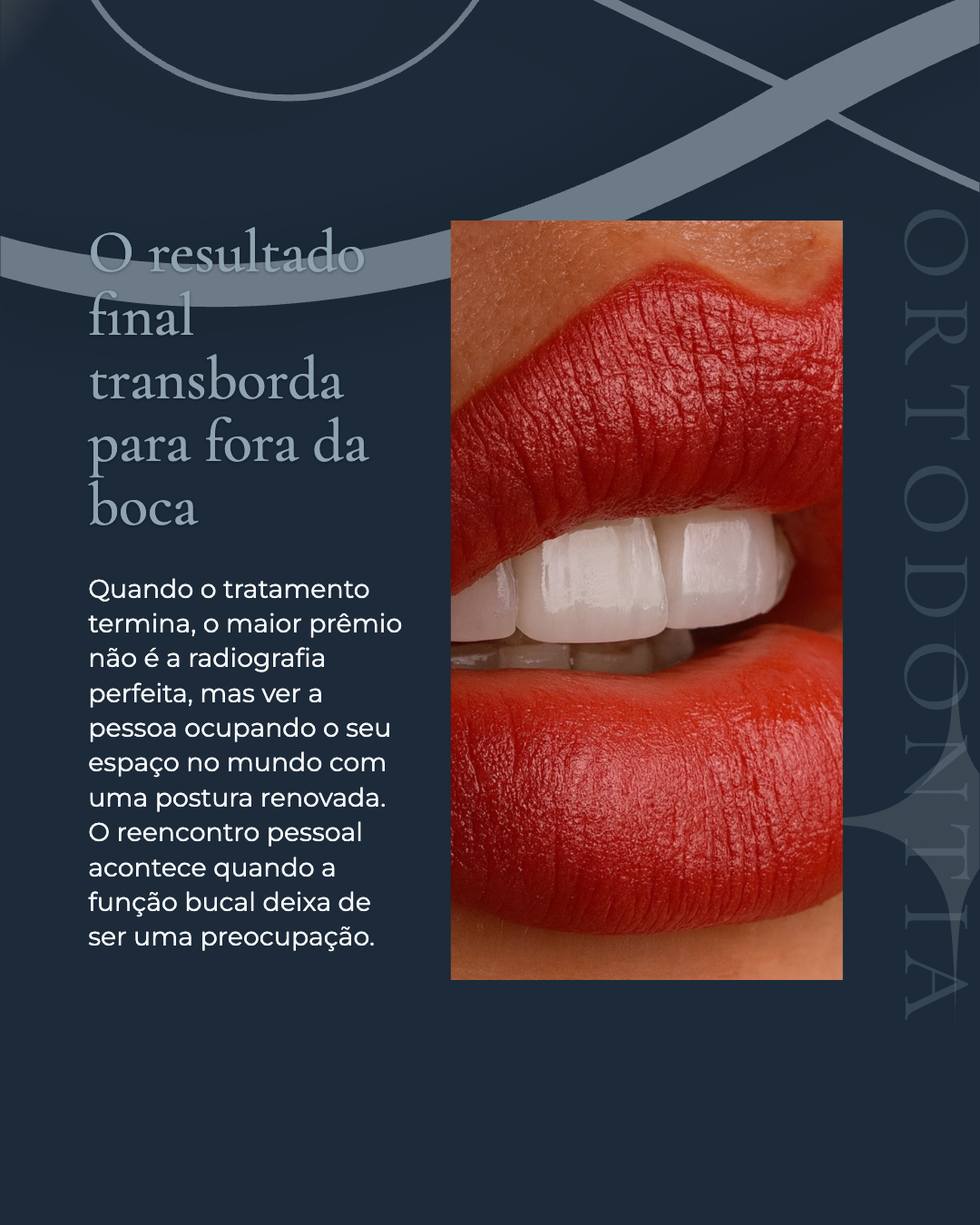 Exemplo de carrossel extra 7