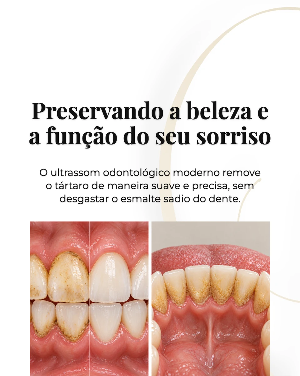 Slide 5 de 5 de um carrossel gerado automaticamente