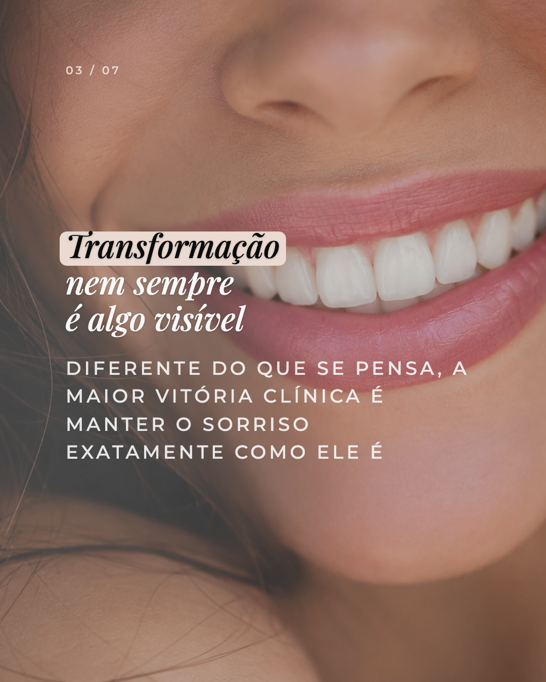 Exemplo de carrossel 3