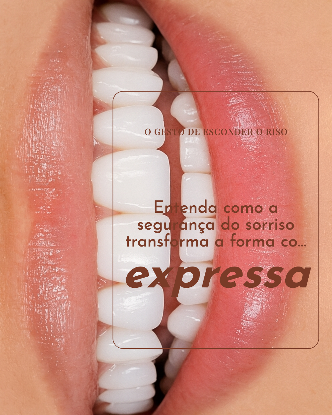 Exemplo de carrossel extra 1