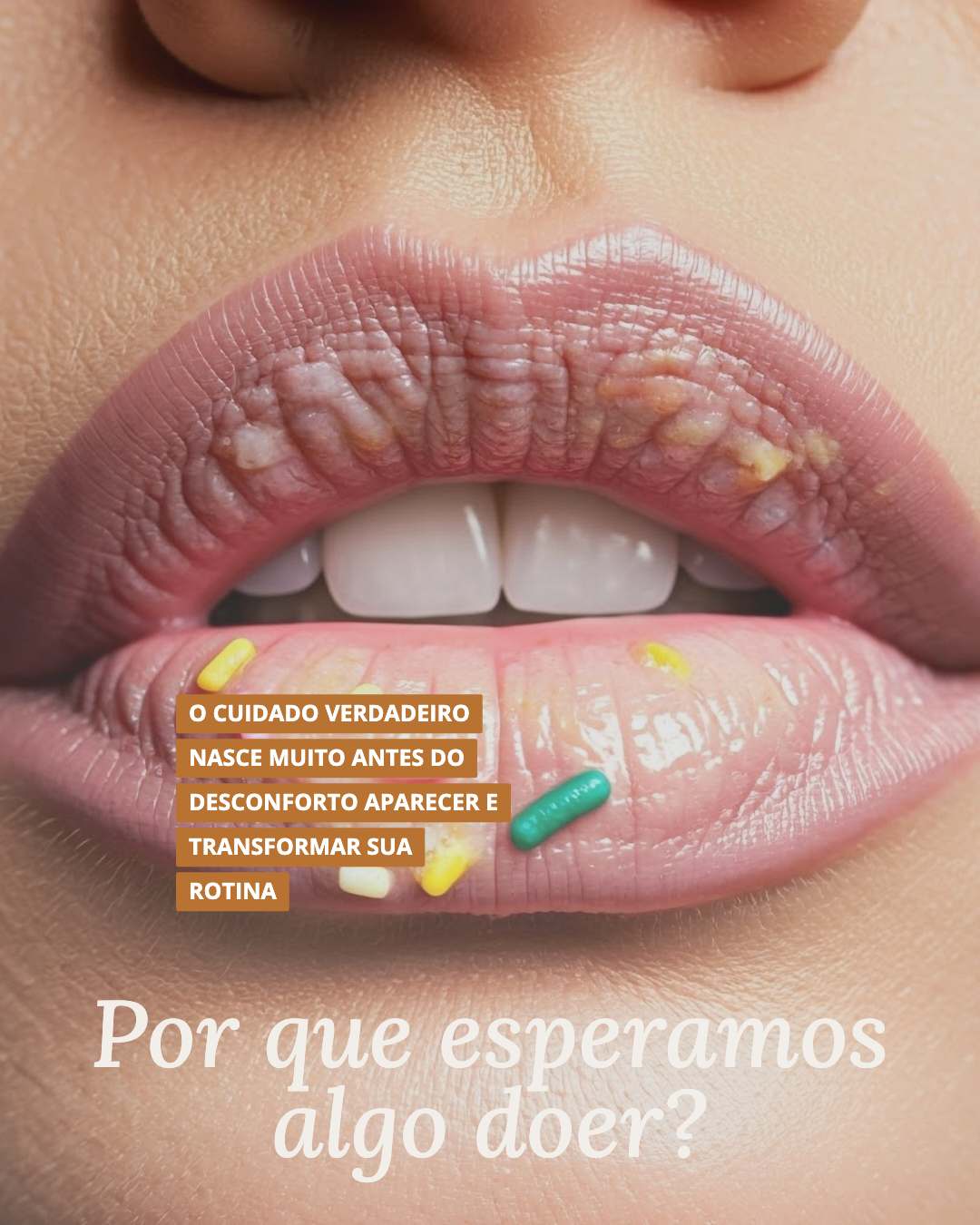 Layout de capa 2
