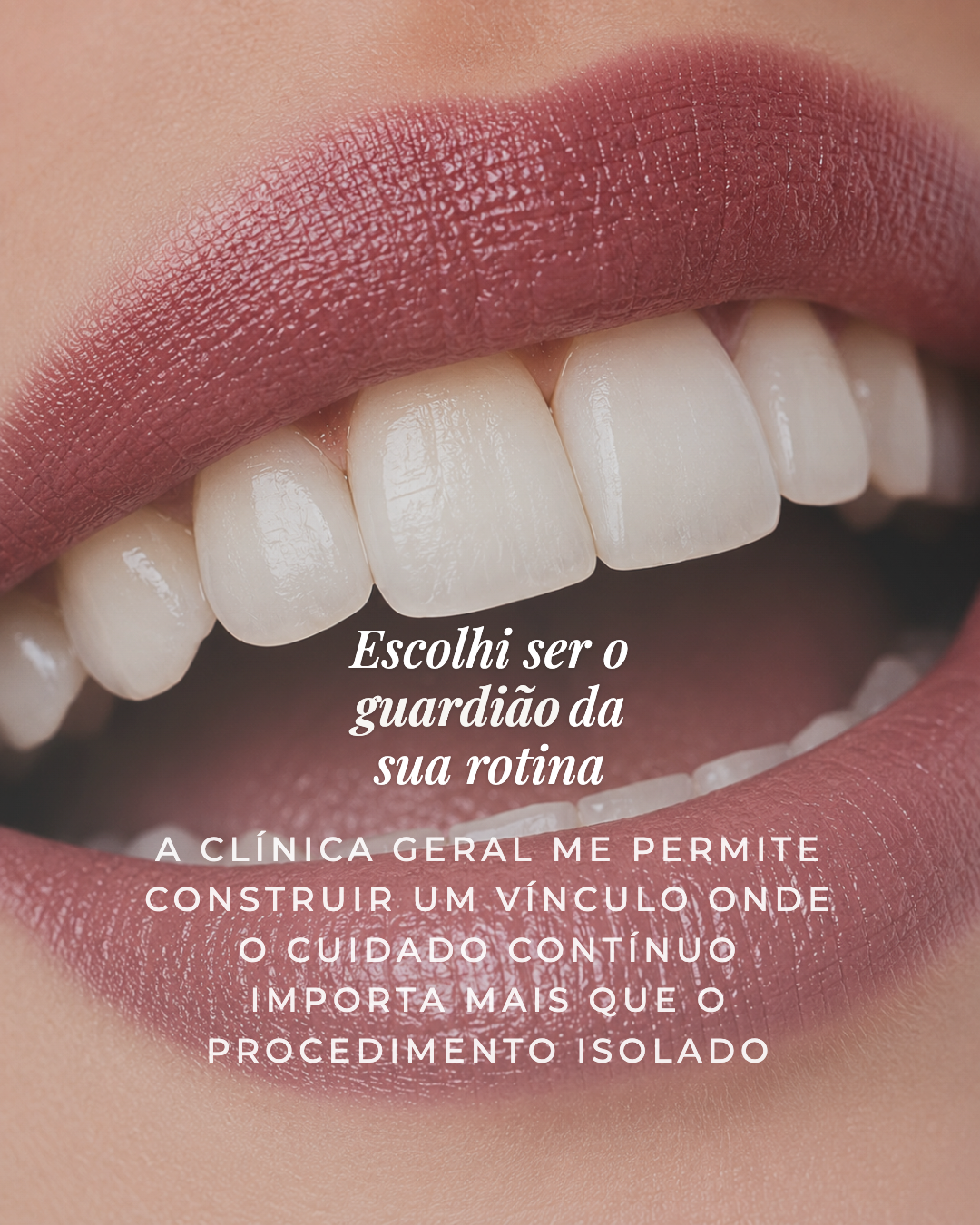 Exemplo de carrossel adicional 4