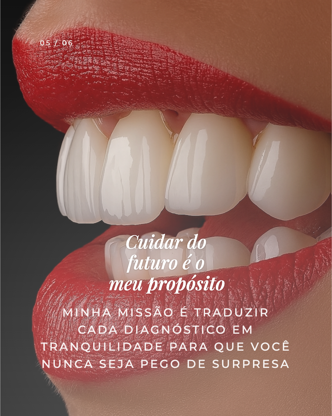 Exemplo de carrossel adicional 5