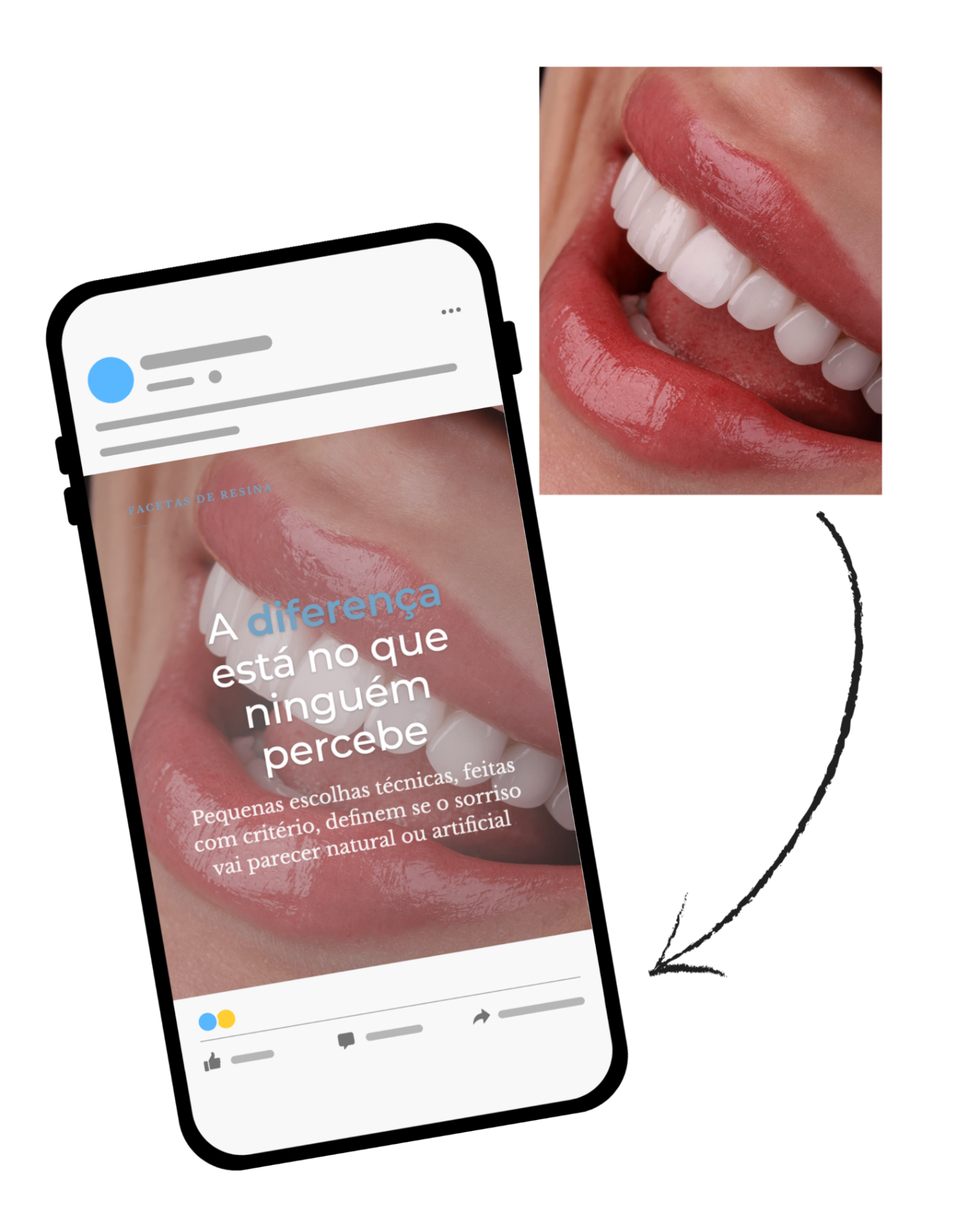 Mockup com fotos do banco Post Pra Dentista