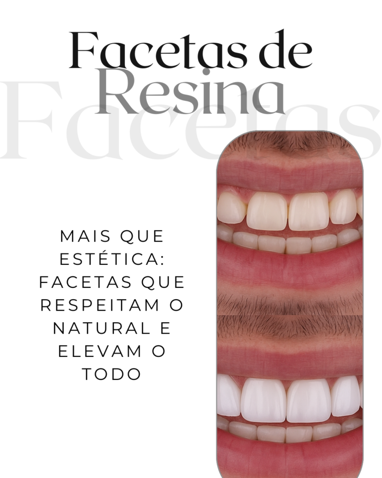 Post 24