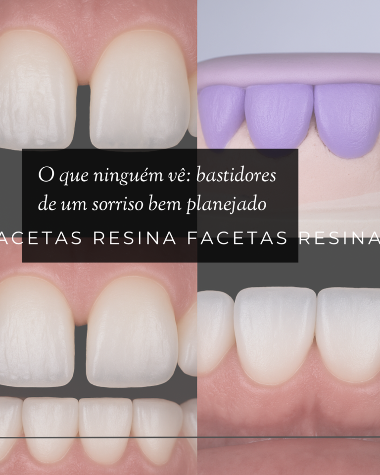 Post 25